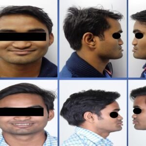 Orthognathic Surgeries