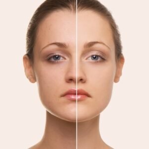 Skin Lightening Treatments